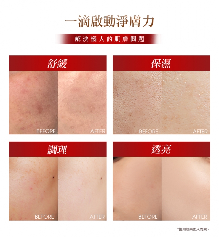 76酵母胺基酸淨膚潔顏露（防滑升級版）150g