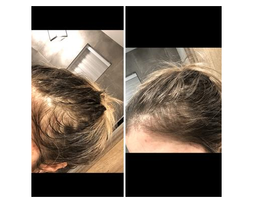 Kerastase - Initialiste 高級頭皮和頭髮濃縮液（免洗） 60mL